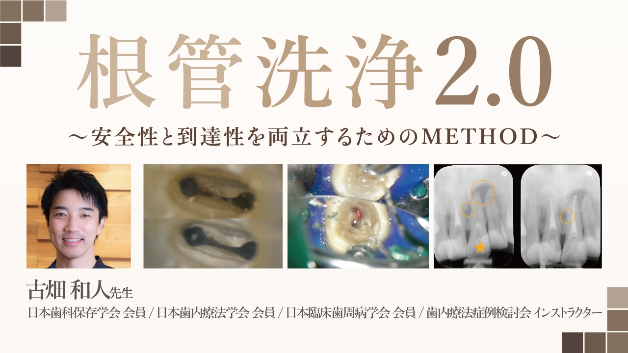 根管洗浄2.0〜安全性と到達性を両立するためのMETHOD〜 | WHITE CROSS
