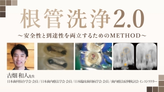 根管洗浄2.0〜安全性と到達性を両立するためのMETHOD〜の画像です。