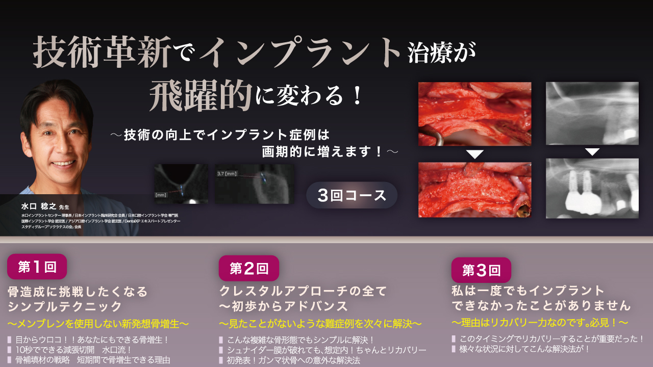 技術革新でインプラント治療が飛躍的に変わる！3回コース～技術