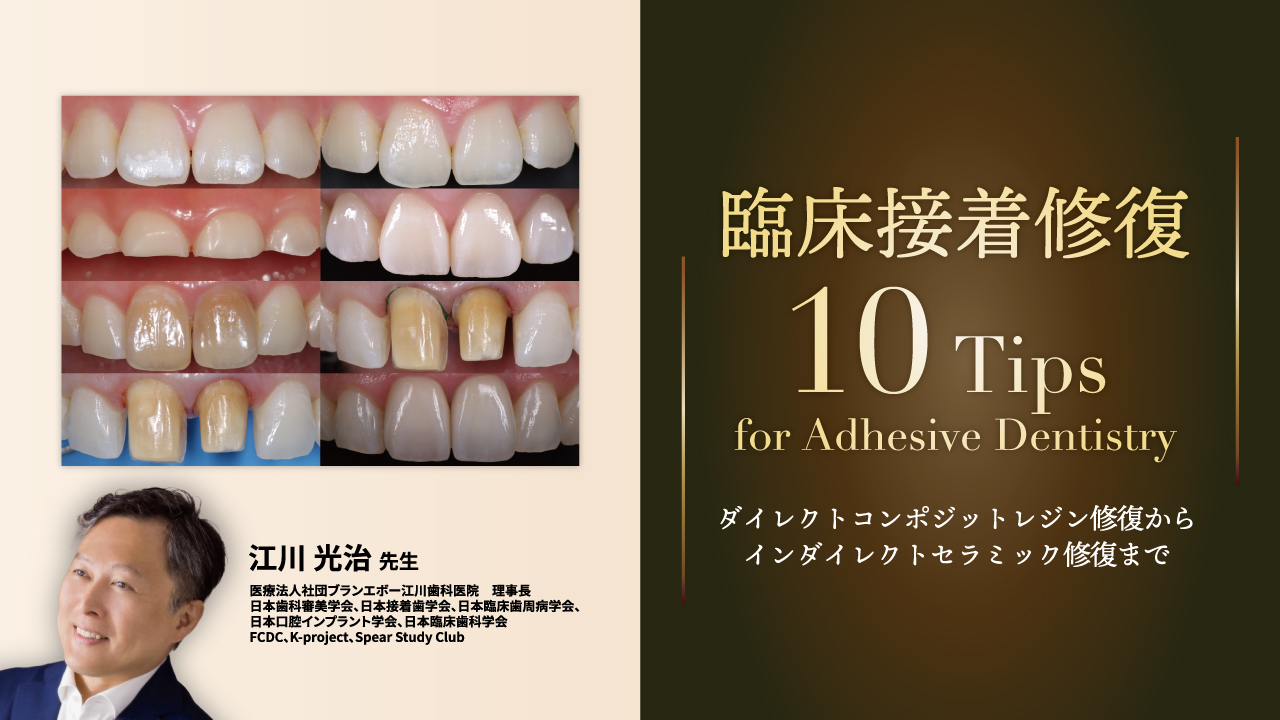 臨床接着修復10Tips for Adhesive Dentistry〜ダイレクトコンポジットレジン修復からインダイレクトセラミック修復まで〜の画像です。