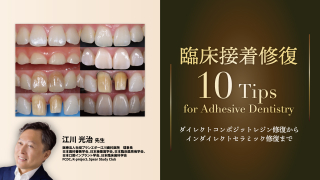 臨床接着修復10Tips for Adhesive Dentistry〜ダイレクトコンポジットレジン修復からインダイレクトセラミック修復まで〜の画像です。