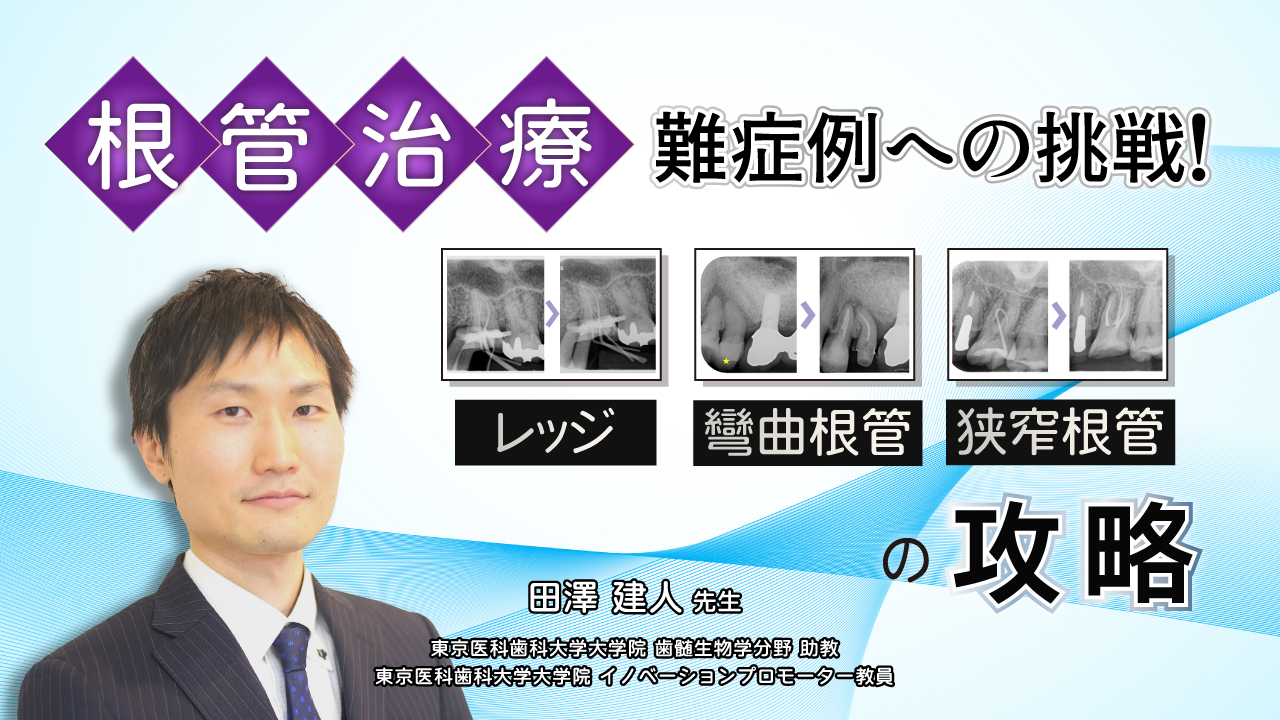 根管治療難症例への挑戦！〜レッジ、彎曲根管、狭窄根管の攻略〜の画像です。