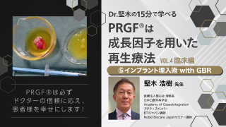 Dr.堅木の15分で学べる〜PRGF®は成長因子を用いた再生療法【Vol.4 ⑤インプラント埋入術 with GBR】〜の画像です。