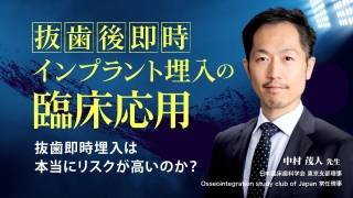 抜歯後即時インプラント埋入の臨床応用の画像です。