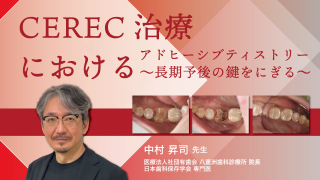 CEREC治療におけるアドヒーシブティストリー〜長期予後の鍵をにぎる〜の画像です。