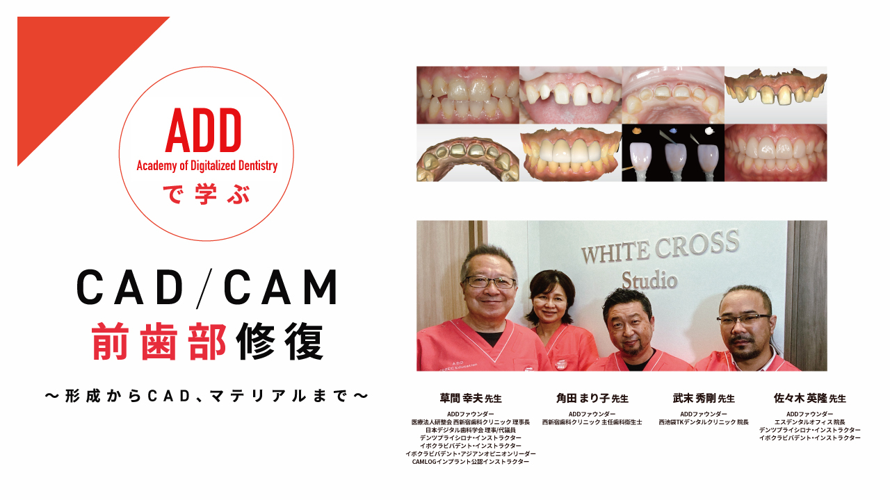 ADDで学ぶ CAD/CAM前歯部修復〜形成からCAD、マテリアルまで〜 | WHITE CROSS