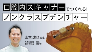 口腔内スキャナーでつくれる！ノンクラスプデンチャーの画像です。