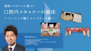 最新エビデンスに基づく口腔内スキャナーの臨床〜ベーシック編とインプラント編〜の画像です。