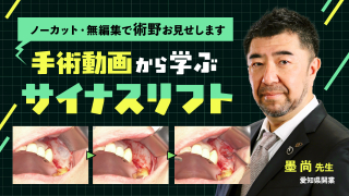 ライブオペで術野がなかなか見れない方必見！手術動画から学ぶ〜サイナスリフト手術の術野をノーカット・無編集でお見せします〜の画像です。