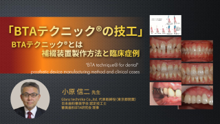 咬合・補綴の臨床マスター 咬合・補綴の臨床マスター 2024年11月のピックアップ書籍