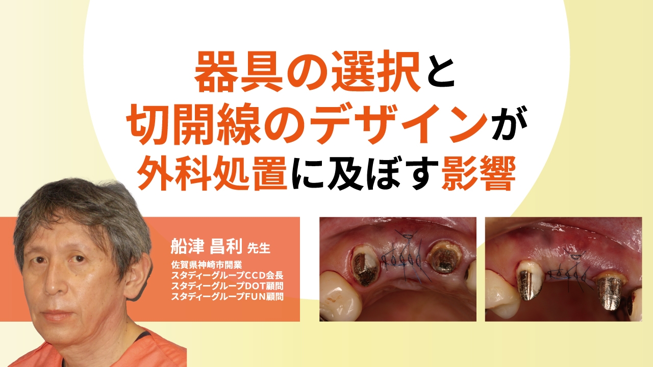 器具の選択と切開線のデザインが外科処置に及ぼす影響 | WHITE CROSS