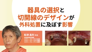 器具の選択と切開線のデザインが外科処置に及ぼす影響の画像です。