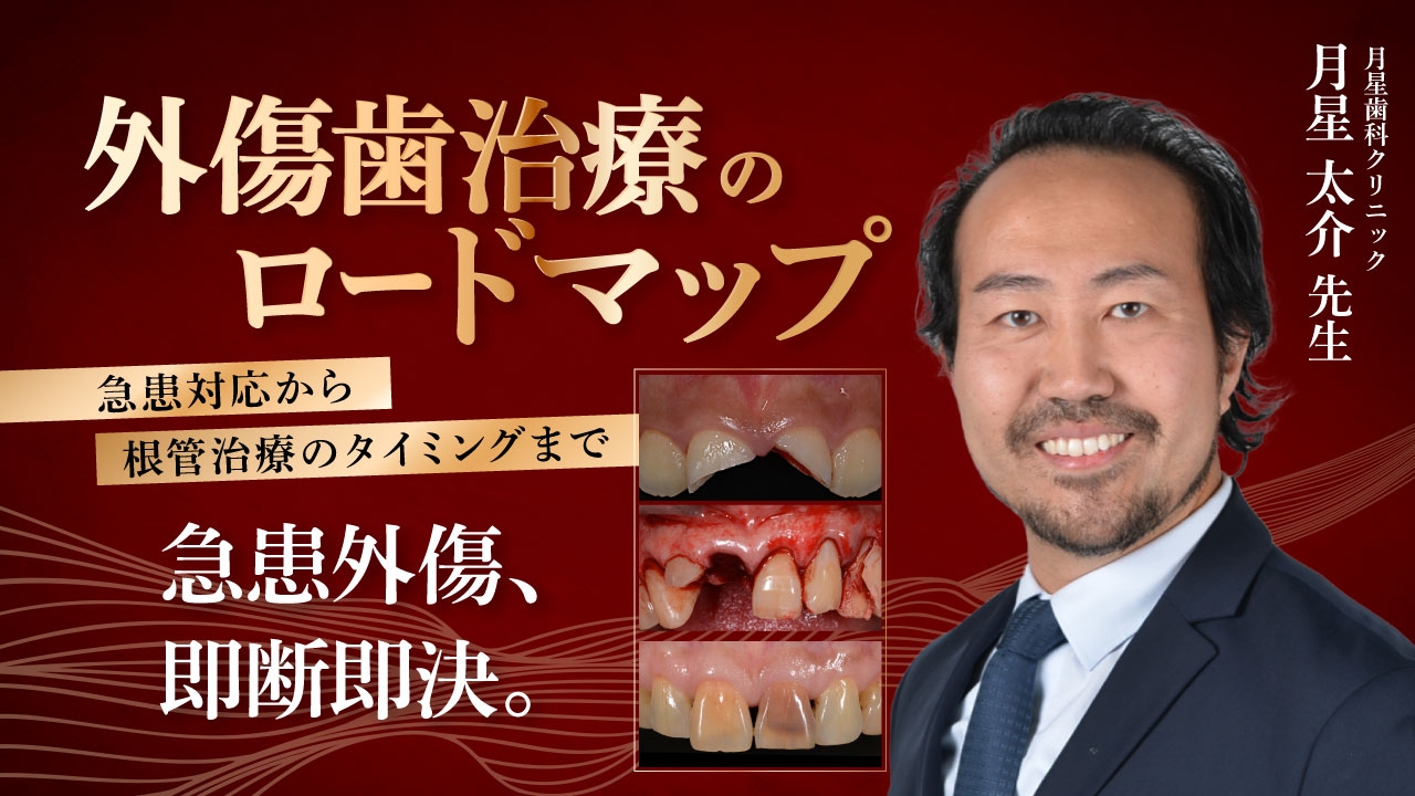 外傷歯治療のロードマップ〜急患対応から根管治療のタイミングまで