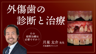 外傷歯の診断と治療〜その根管治療は必要ですか？〜の画像です。