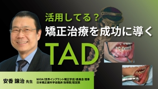 活用してる？矯正治療を成功に導くTADの画像です。