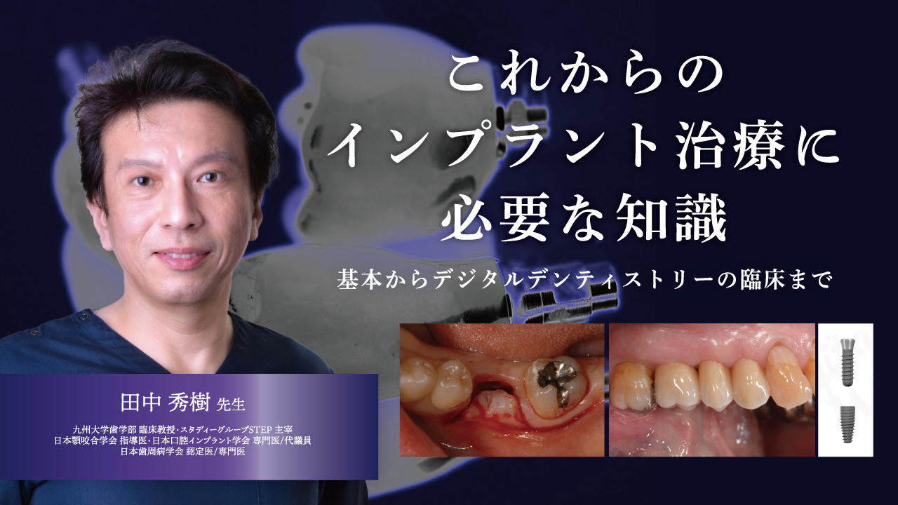 これからのインプラント治療に必要な知識〜基本からデジタルデンティストリーの臨床まで〜の画像です。