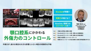 顎口腔系にかかわる外傷力のコントロール～外傷力が、過大な場合の大きな影響と小さい場合の奇跡的な予後～の画像です。