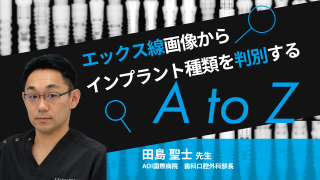 エックス線画像からインプラント種類を判別する A to Zの画像です。