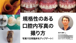 規格性のある口腔内写真の撮り方〜写真で日常臨床をアップデート！〜の画像です。