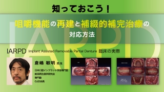知っておこう！咀嚼機能の再建と補綴的補完治療の対応方法の画像です。