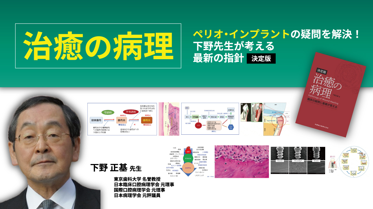 治癒の病理 ペリオ・インプラントの疑問を解決！下野先生が考える最新 