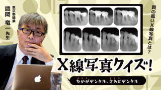 X線写真クイズ〜規格性のあるX線写真の意味を考える〜の画像です。