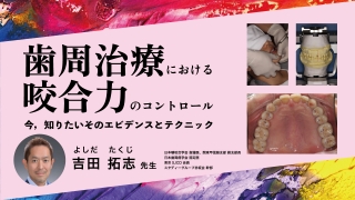 咬合調整のコツとマネジメント | WHITE CROSS