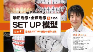 補綴医が作る 矯正治療・全顎治療のための「SET UP 模型」part1〜意義とSET UP模型の製作方法〜の画像です。