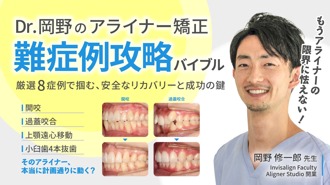 Dr.岡野のアライナー矯正「難症例攻略」バイブル〜厳選8症例で掴む