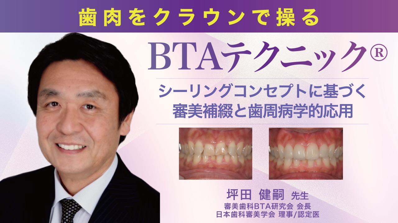 歯肉ラインを整え歯肉退縮を防ぐ 生物学的審美補綴法 BTAテクニックの臨床 歯と歯肉を美しく健康に保つ補綴法 今、話題の「BTAテクニック