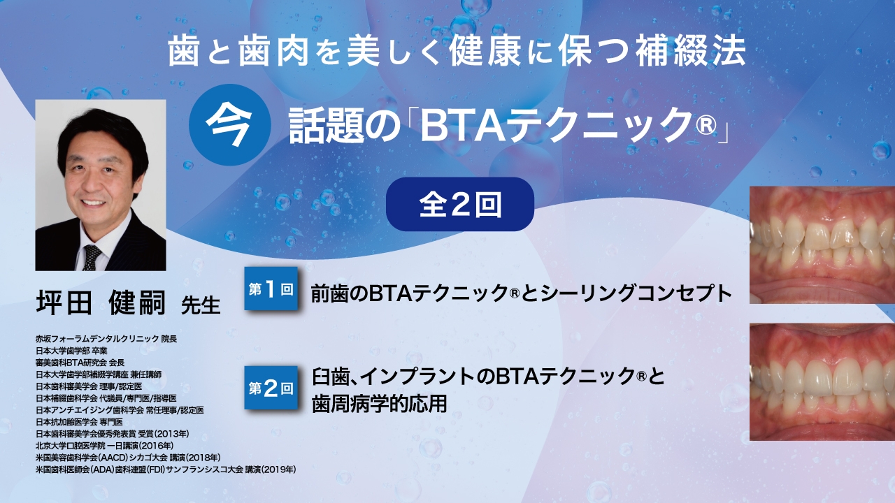 歯と歯肉を美しく健康に保つ補綴法 今、話題の「BTAテクニック®」の画像です。