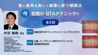 歯と歯肉を美しく健康に保つ補綴法　今、話題の「BTAテクニック®」の画像です。