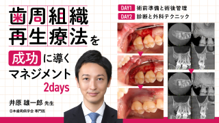 歯周組織再生療法を『成功』に導くマネジメント（2days）の画像です。