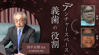 デンチャースペース義歯の役割の画像です。