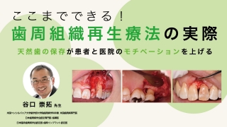 ここまでできる！歯周組織再生療法の実際の画像です。