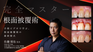 完全マスター「根面被覆術」〜手術ビデオで学ぶ、根面被覆術の最新術式〜の画像です。