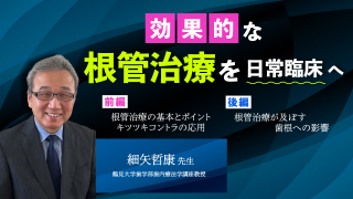 効果的な根管治療を日常臨床への画像です。