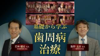 基礎から学ぶ歯周病治療の画像です。