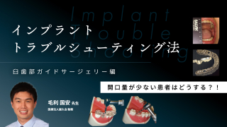 カンタン！確実！骨造成〜臼歯部のオープンバリアメンブレンテクニック