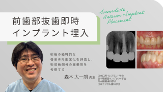 つまずきポイントを解説！切開・剥離・縫合をマスターせよ