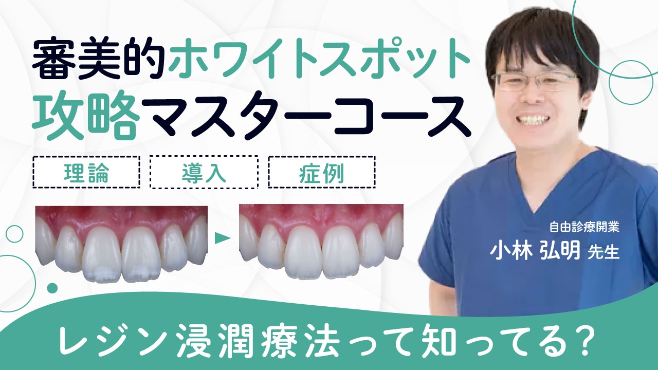 審美的ホワイトスポット攻略マスターコース〜理論・導入・症例〜の画像です。
