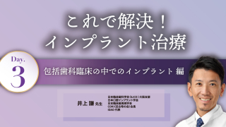 サイナスフロアエレベーション アルティメットガイド 全てを満たす究極