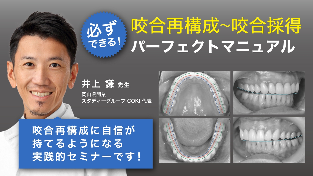 誰にでもできる咬合採得 必ずできる！咬合再構成〜咬合採得パーフェクトマニュアル〜 | WHITE CROSS