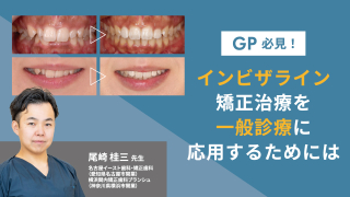 GP必見！インビザライン矯正治療を一般診療に応用するためにはの画像です。