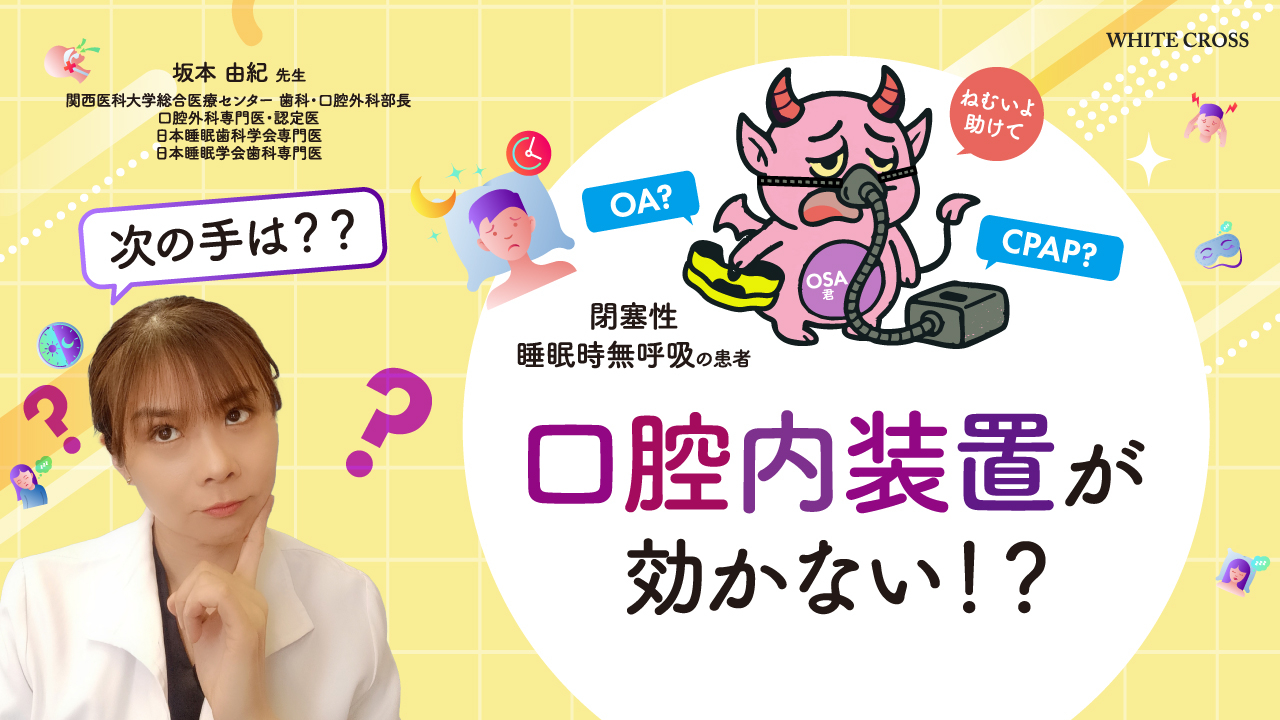 閉塞性睡眠時無呼吸の患者 口腔内装置が効かない！？次の手は？？の画像です。