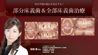 ステップごとに答える 総義歯臨床120のポイント: 吸着する義歯床・安定した咬合を得るために 村岡 博 ステップごとに答える 総義歯臨床120のポイント: 吸着する義歯床・安定
