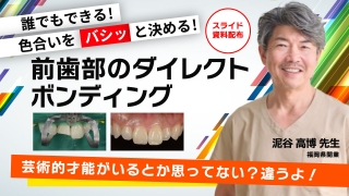 誰でもできる！色合いをバシッと決める！前歯部のダイレクトボンディングの画像です。