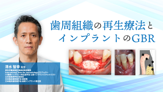 失敗から学ぶインプラント治療～33歳の自分にちょっとモノ申す