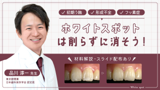 ホワイトスポットは削らずに消そう！ の画像です。