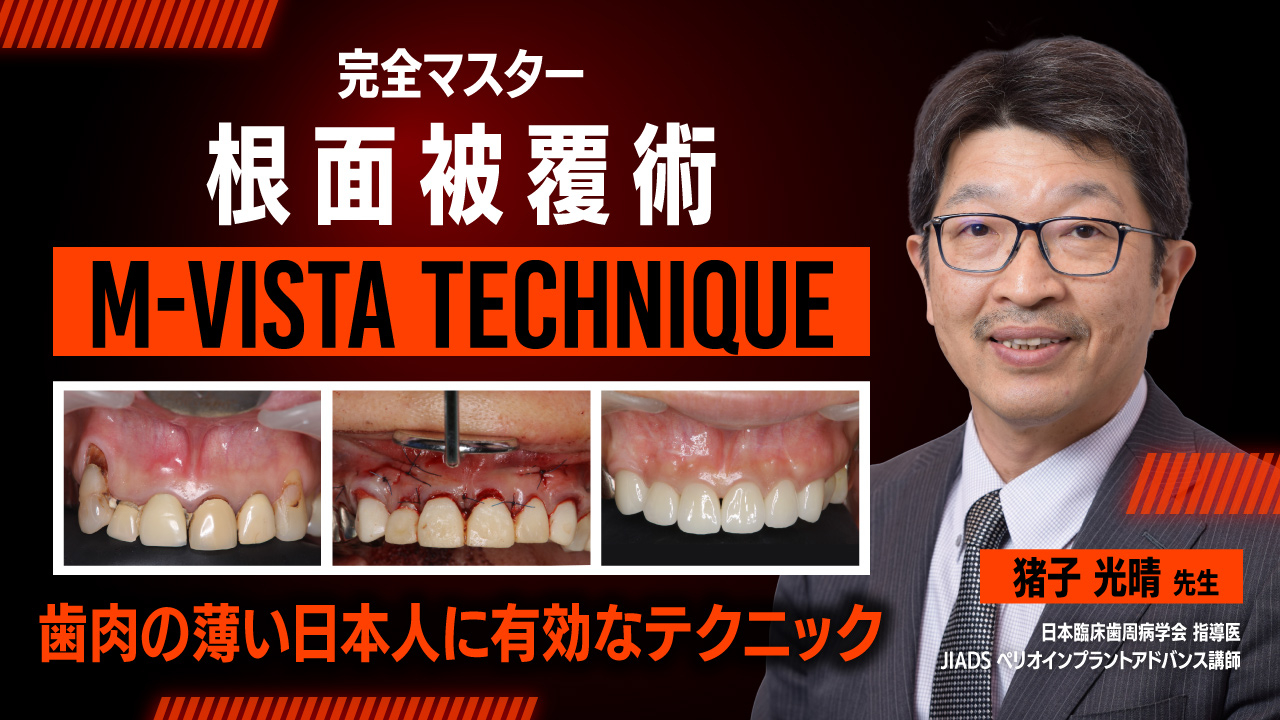 本 歯周外科の臨床とテクニック